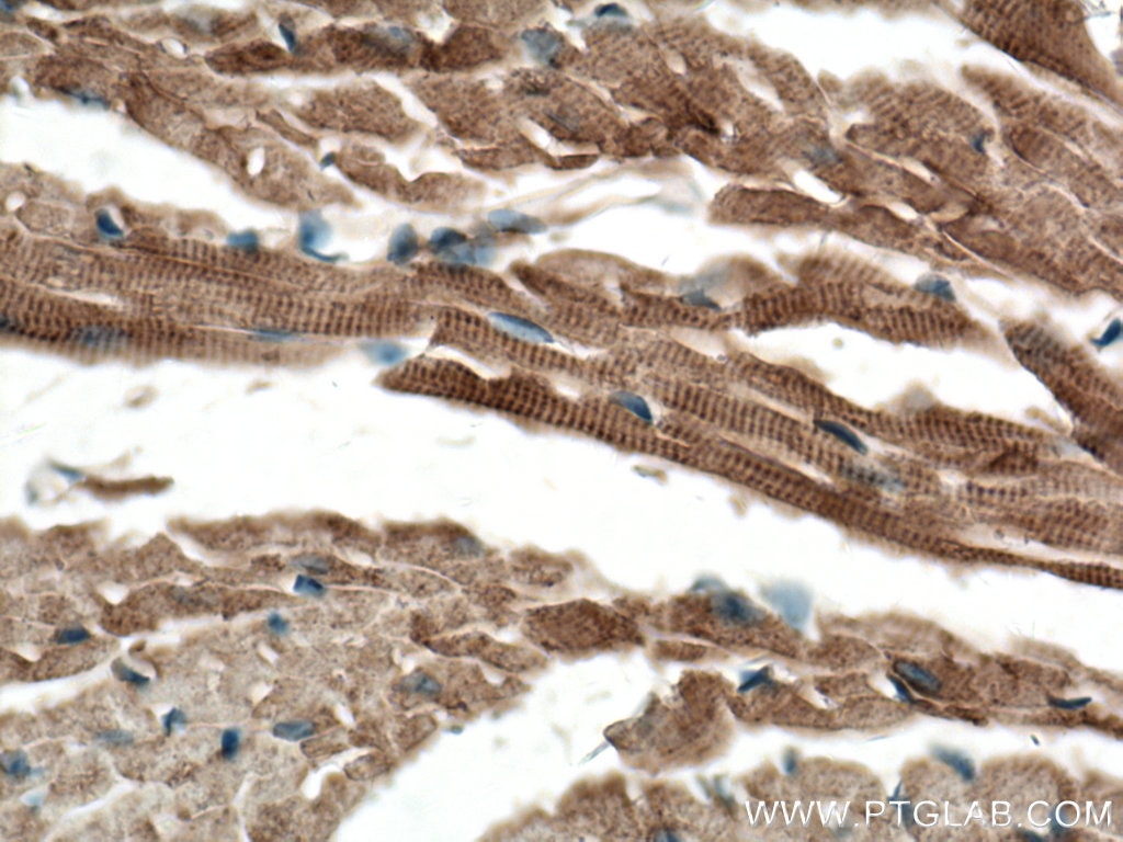 Immunohistochemistry (IHC) staining of mouse heart tissue using Alpha B Crystallin Polyclonal antibody (15808-1-AP)