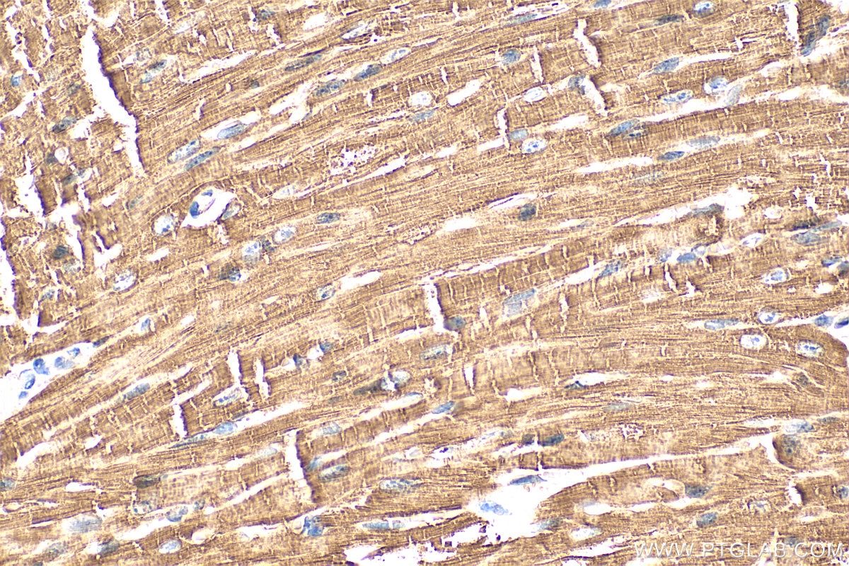 Immunohistochemistry (IHC) staining of mouse heart tissue using Alpha B Crystallin Polyclonal antibody (15808-1-AP)