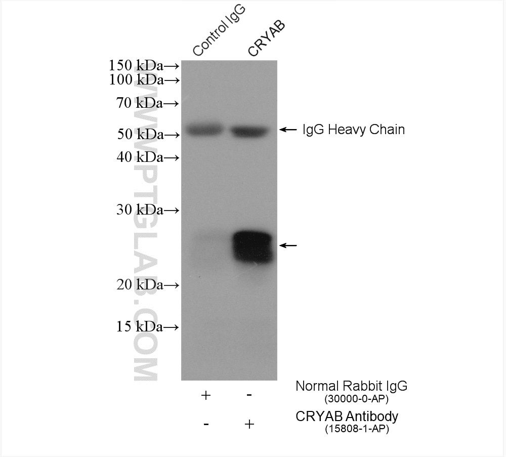 Immunoprecipitation (IP) experiment of U2OS cells using Alpha B Crystallin Polyclonal antibody (15808-1-AP)