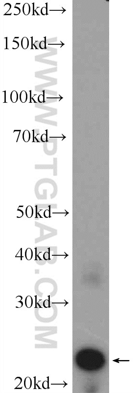 Western Blot (WB) analysis of mouse eye tissue using CRYBA2 Polyclonal antibody (15750-1-AP)