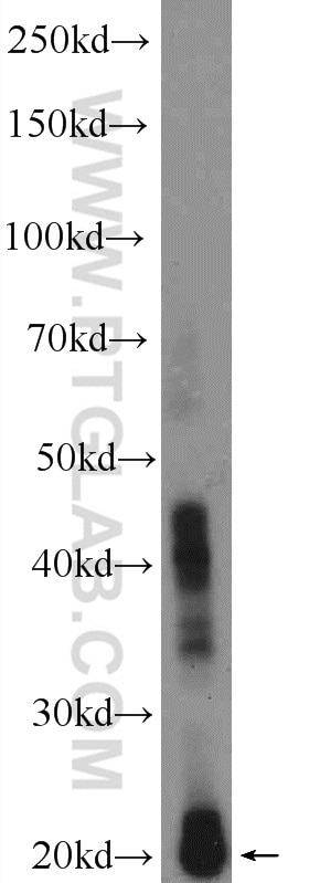 Western Blot (WB) analysis of rat eye tissue using CRYBA2 Polyclonal antibody (15750-1-AP)