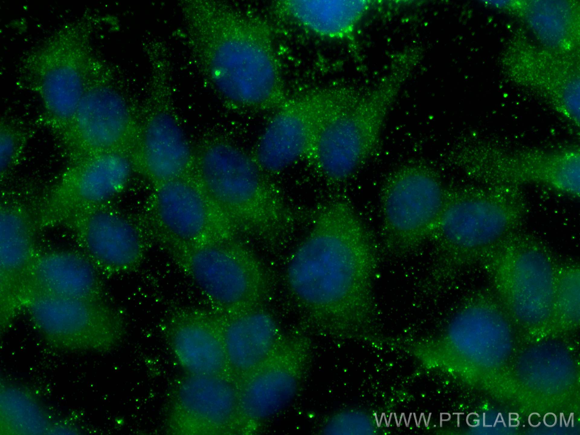Immunofluorescence (IF) / fluorescent staining of hTERT-RPE1 cells using CRYBB1 Monoclonal antibody (60273-1-Ig)