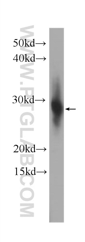 Western Blot (WB) analysis of mouse eye tissue using CRYBB1 Monoclonal antibody (60273-1-Ig)