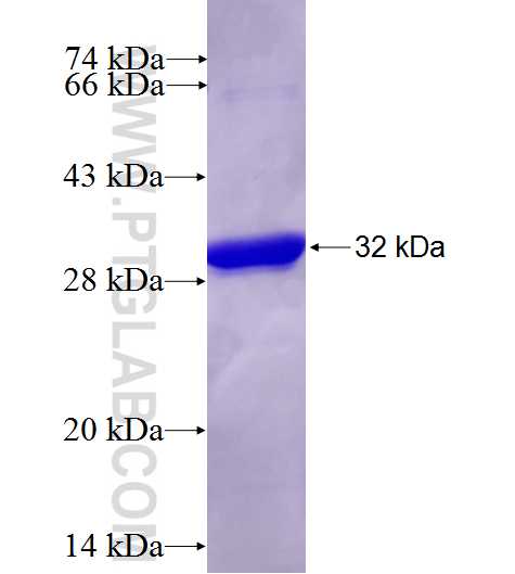 CRYBB1 fusion protein Ag4722 SDS-PAGE