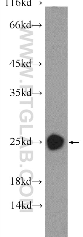 Western Blot (WB) analysis of mouse brain tissue using CRYBB2 Polyclonal antibody (18154-1-AP)