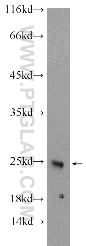 Western Blot (WB) analysis of fetal human brain tissue using CRYBB2 Polyclonal antibody (18154-1-AP)