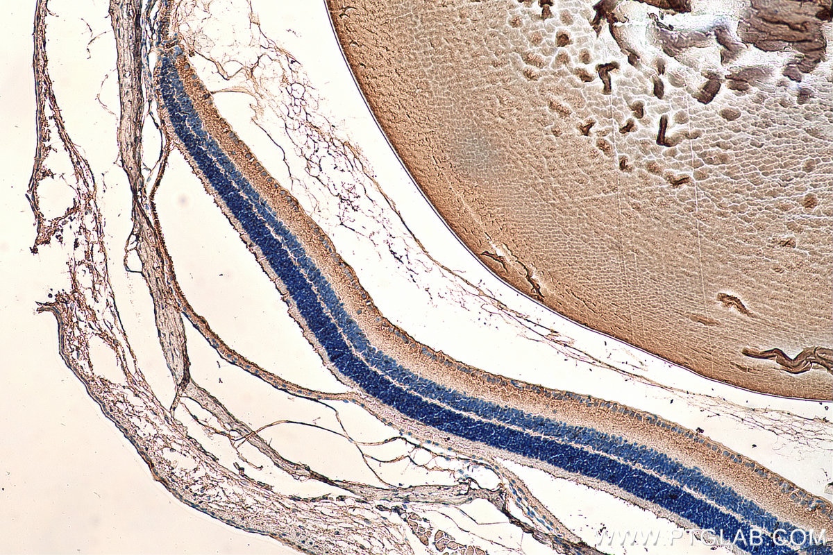 IHC staining of mouse eye using 21009-1-AP