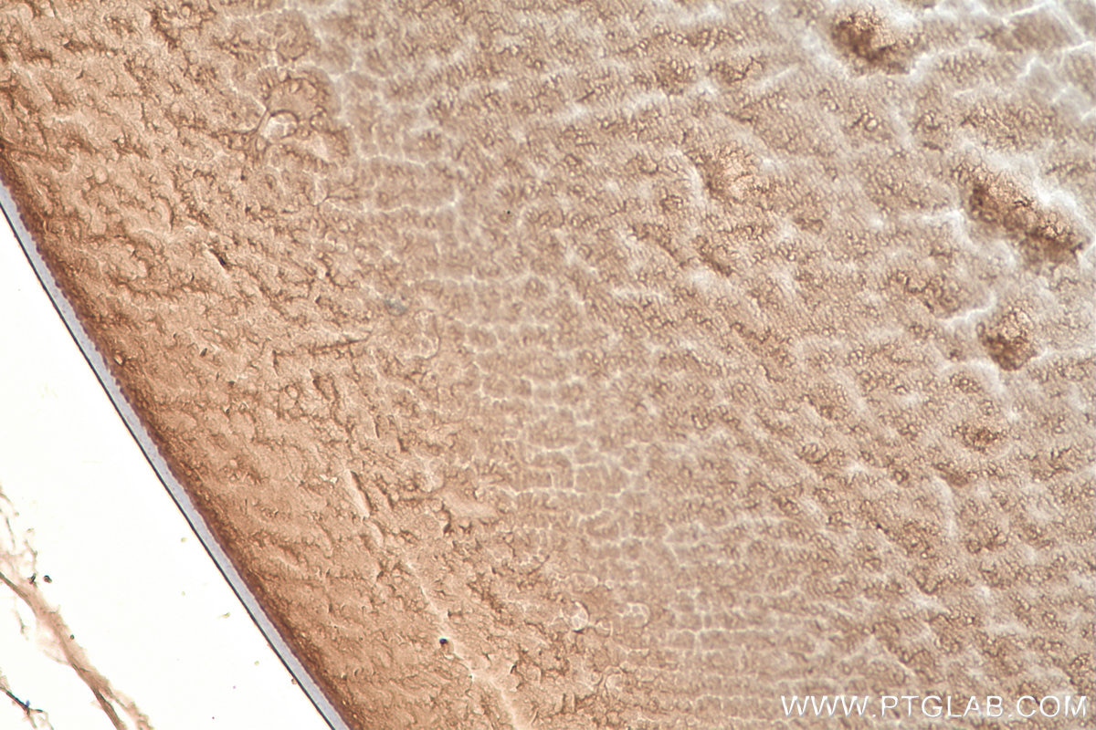 Immunohistochemistry (IHC) staining of mouse eye tissue using CRYBB3 Polyclonal antibody (21009-1-AP)