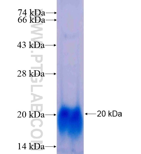 CRYBB3 fusion protein Ag15216 SDS-PAGE