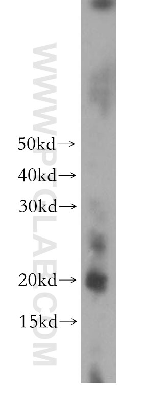 Western Blot (WB) analysis of human brain tissue using CRYGC Polyclonal antibody (17931-1-AP)