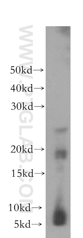 Western Blot (WB) analysis of human brain tissue using CRYGC Polyclonal antibody (17931-1-AP)