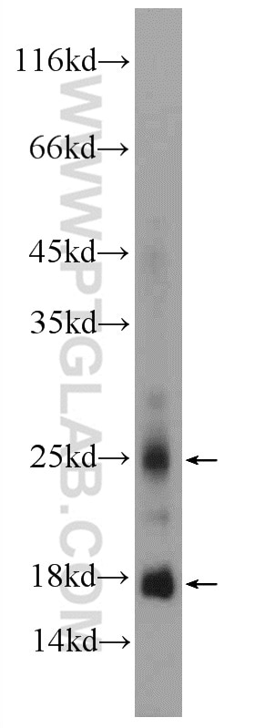 Western Blot (WB) analysis of mouse eye tissue using CRYGN Polyclonal antibody (21281-1-AP)