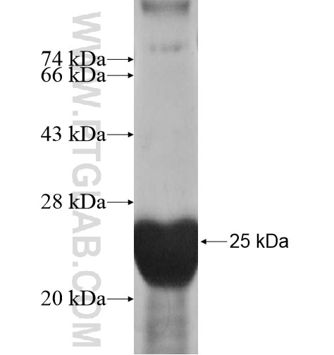 CRYGS fusion protein Ag10481 SDS-PAGE