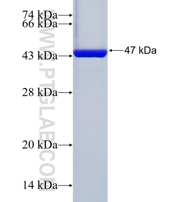 CRYGS fusion protein Ag9868 SDS-PAGE