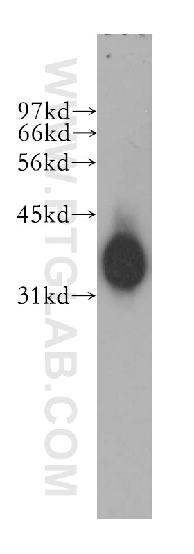 Western Blot (WB) analysis of human heart tissue using Mu Crystallin Polyclonal antibody (12495-1-AP)