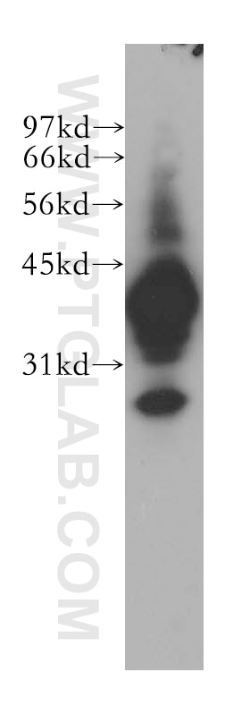 Western Blot (WB) analysis of human kidney tissue using Mu Crystallin Polyclonal antibody (12495-1-AP)