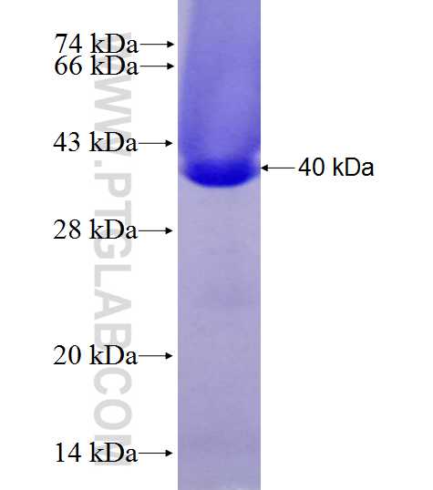 CRYM fusion protein Ag27865 SDS-PAGE
