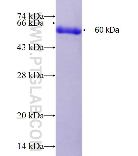 CRYM fusion protein Ag3161 SDS-PAGE