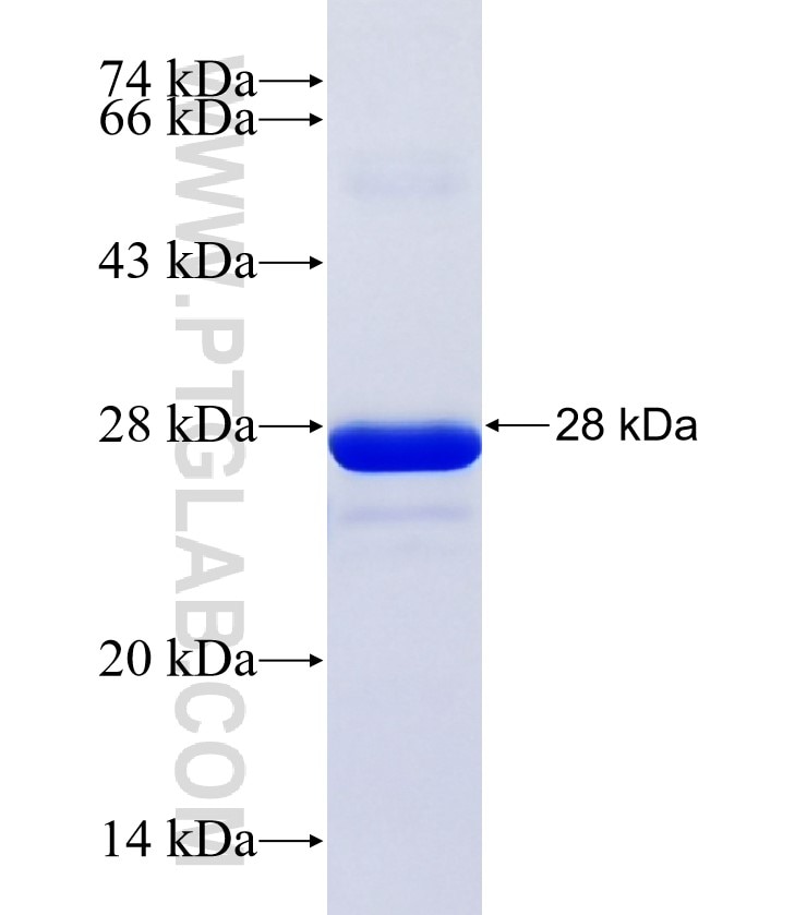 CRYZ fusion protein Ag35459 SDS-PAGE CRYZ fusion protein Ag35459 SDS-PAGE