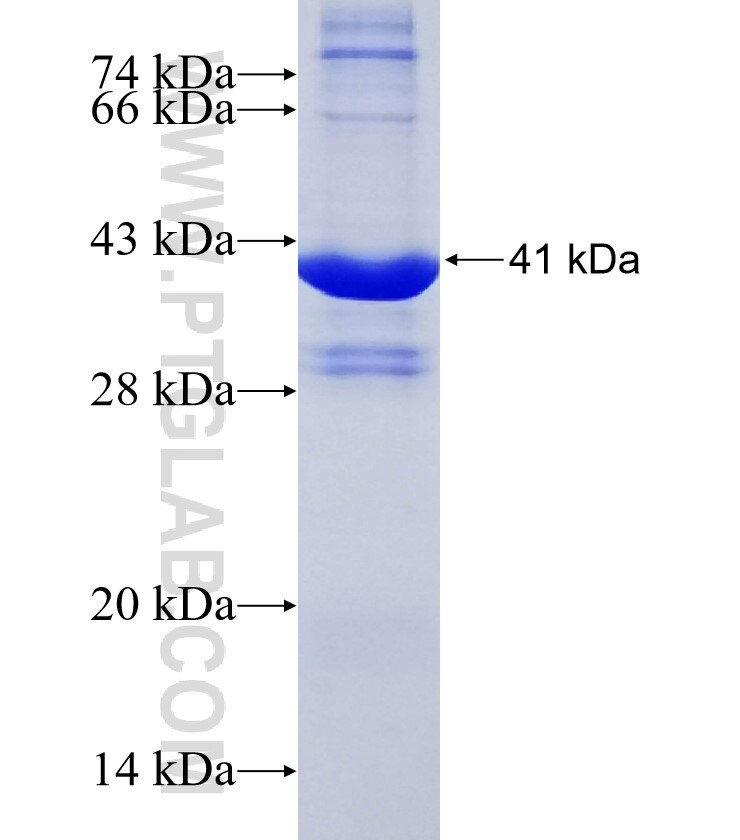 CRYZL1 fusion protein Ag10419 SDS-PAGE