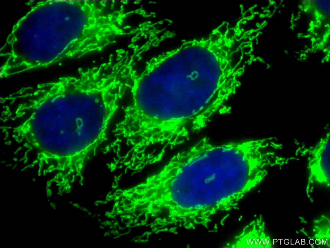 Immunofluorescence (IF) / fluorescent staining of HepG2 cells using Citrate synthase Polyclonal antibody (16131-1-AP)