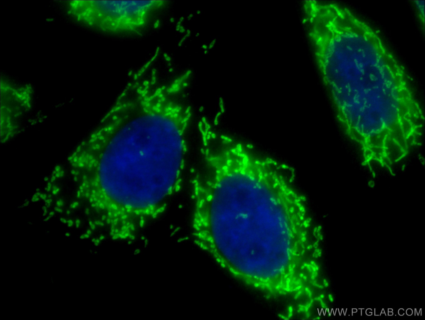 Immunofluorescence (IF) / fluorescent staining of HepG2 cells using Citrate synthase Polyclonal antibody (16131-1-AP)