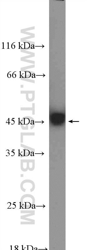 Western Blot (WB) analysis of HeLa cells using Citrate synthase Polyclonal antibody (16131-1-AP)