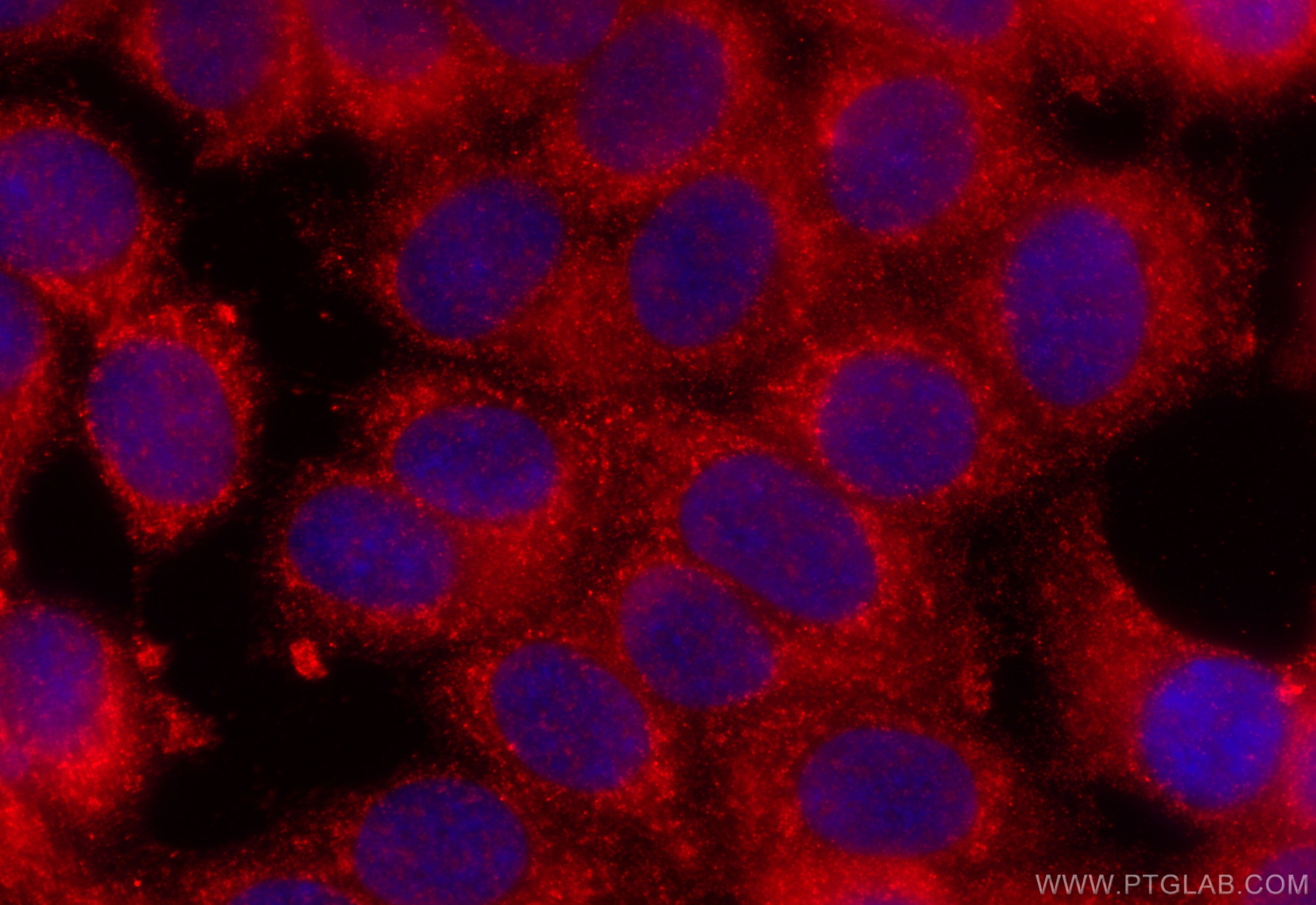 Immunofluorescence (IF) / fluorescent staining of MCF-7 cells using CSAD Polyclonal antibody (22870-1-AP)
