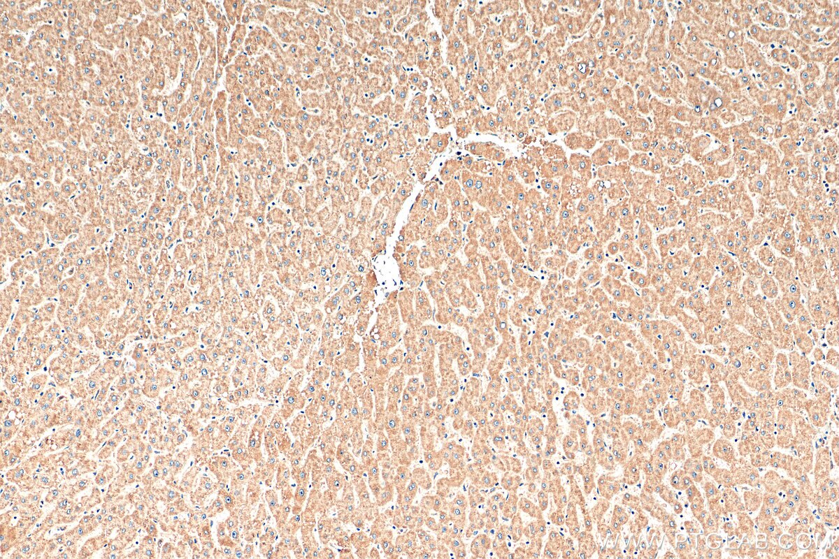 IHC staining of human liver using 22870-1-AP