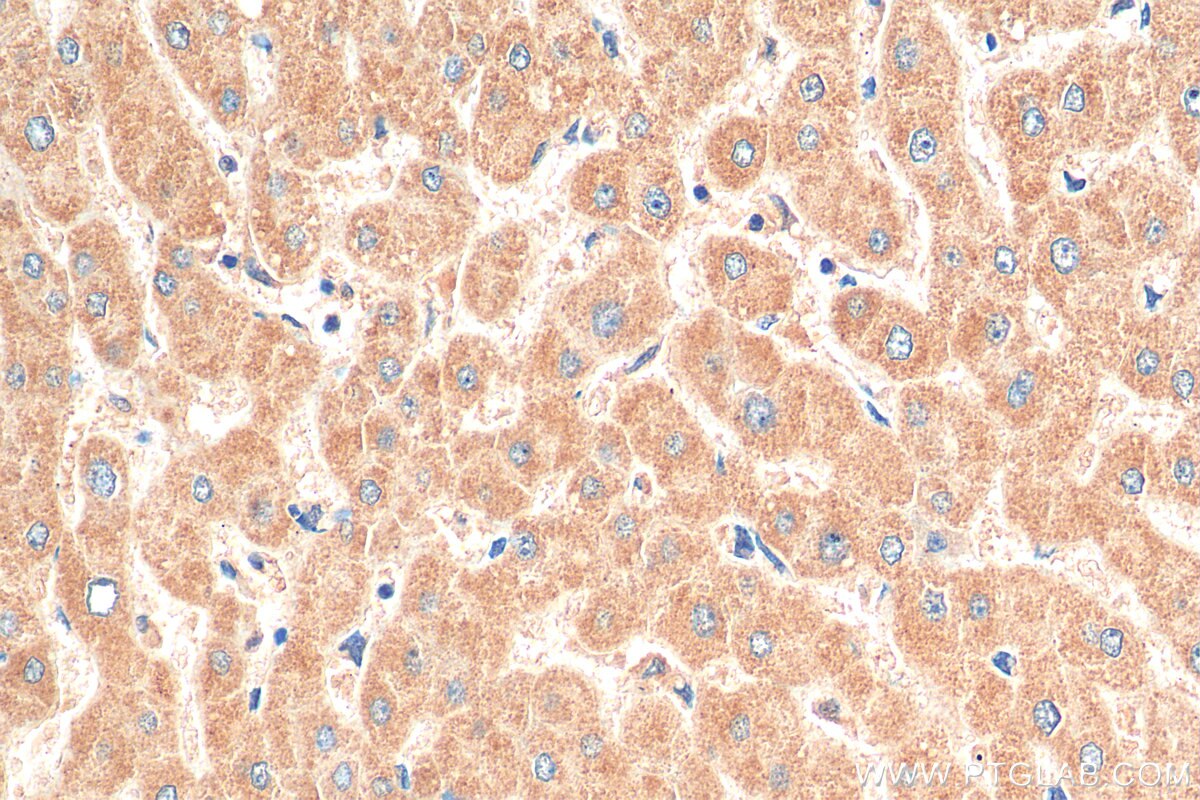 Immunohistochemistry (IHC) staining of human liver tissue using CSAD Polyclonal antibody (22870-1-AP)