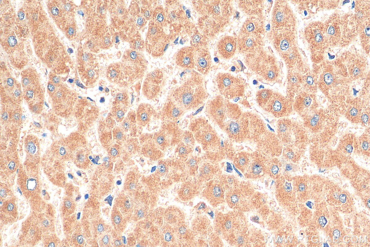 IHC staining of human liver using 22870-1-AP