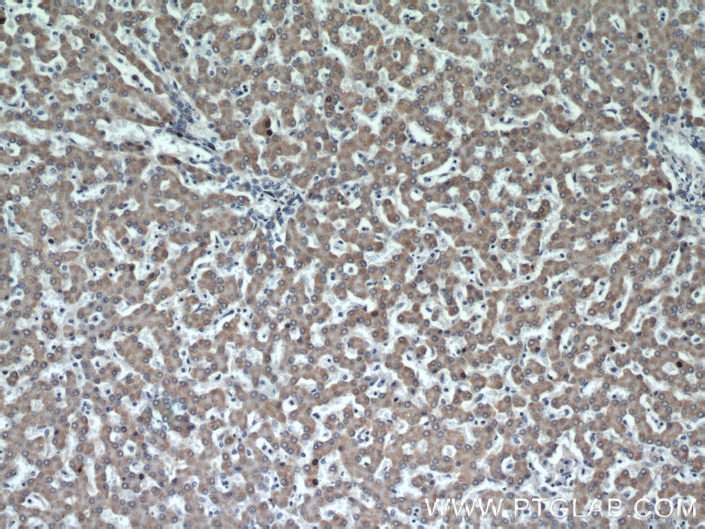 Immunohistochemistry (IHC) staining of human liver tissue using CSAD Polyclonal antibody (22870-1-AP)