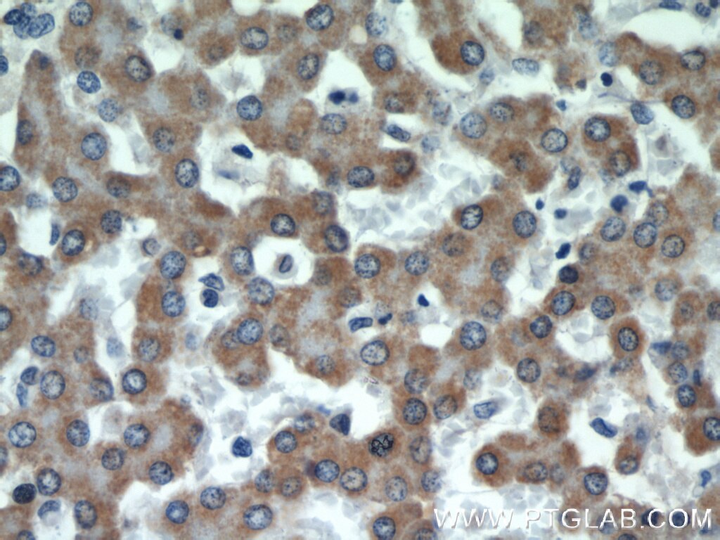 Immunohistochemistry (IHC) staining of human liver tissue using CSAD Polyclonal antibody (22870-1-AP)