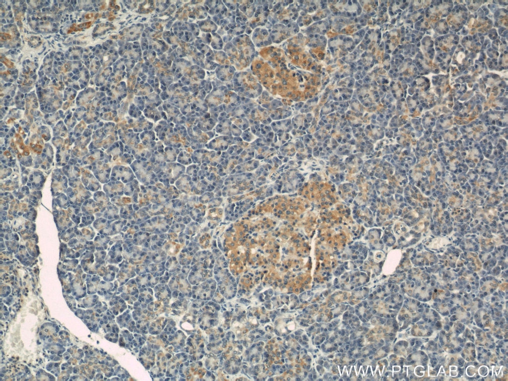 IHC staining of human pancreas using 22870-1-AP