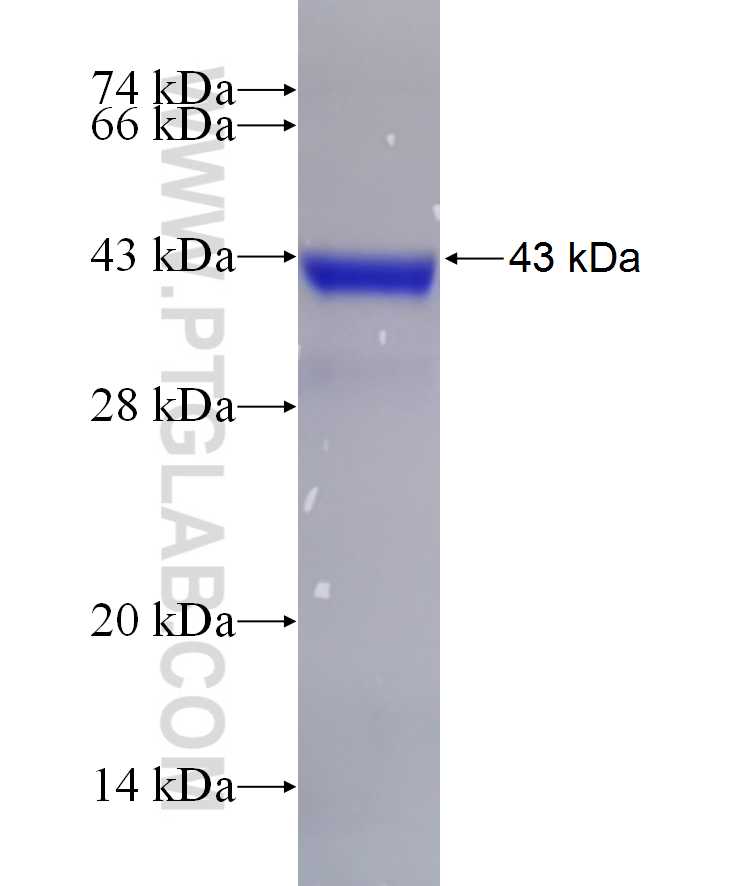 CSAD fusion protein Ag15828 SDS-PAGE