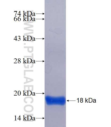 CSAD fusion protein Ag16984 SDS-PAGE