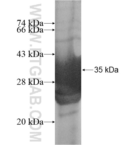 CSAG1 fusion protein Ag11767 SDS-PAGE