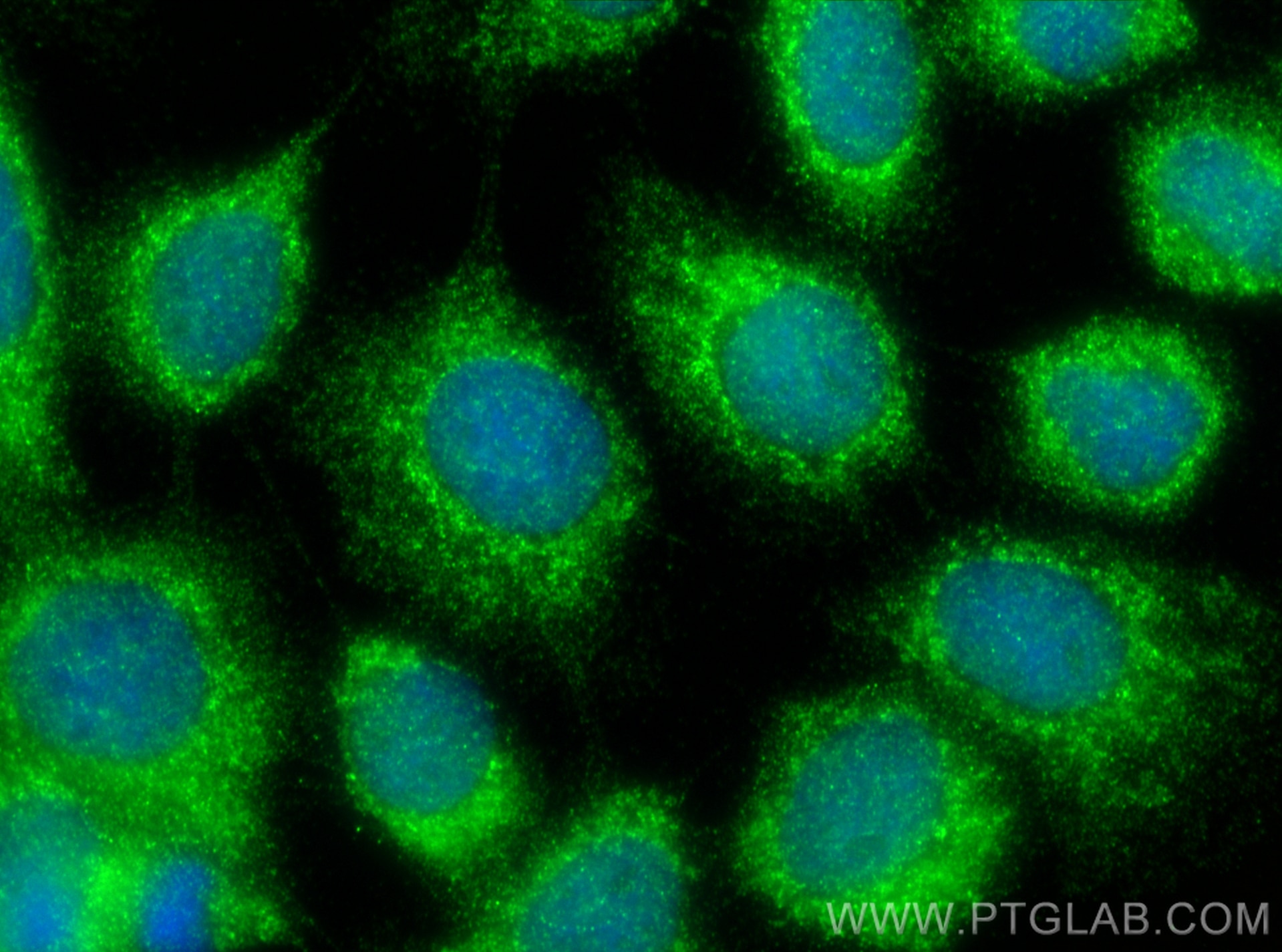 Immunofluorescence (IF) / fluorescent staining of A431 cells using CSDA Polyclonal antibody (27785-1-AP)