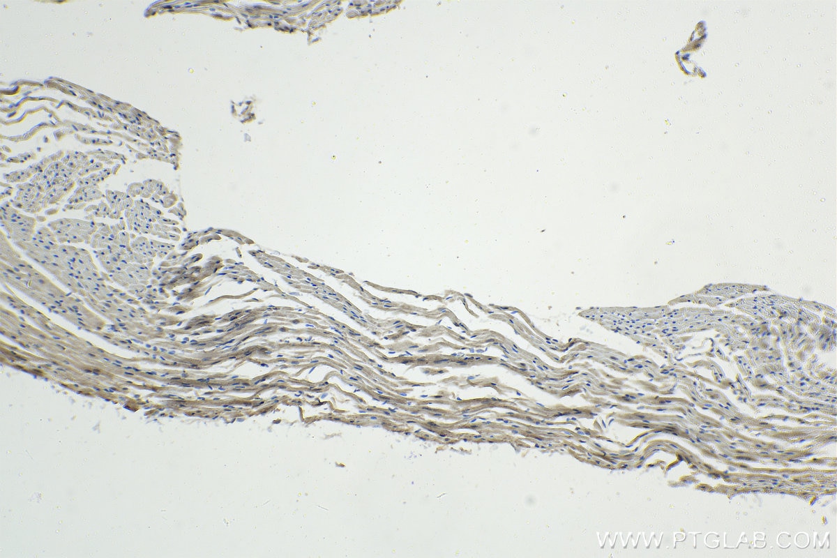 IHC staining of mouse heart using 27785-1-AP