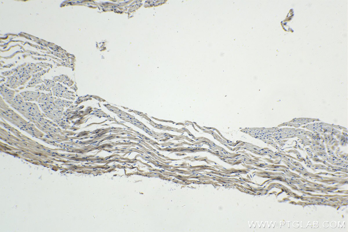 Immunohistochemistry (IHC) staining of mouse heart tissue using CSDA Polyclonal antibody (27785-1-AP)