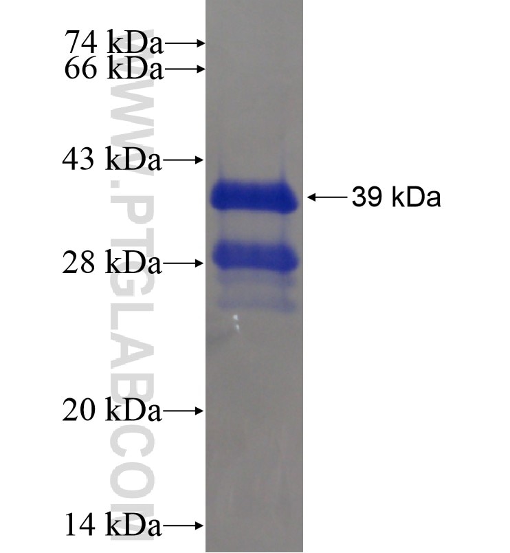 CSDC2 fusion protein Ag16216 SDS-PAGE