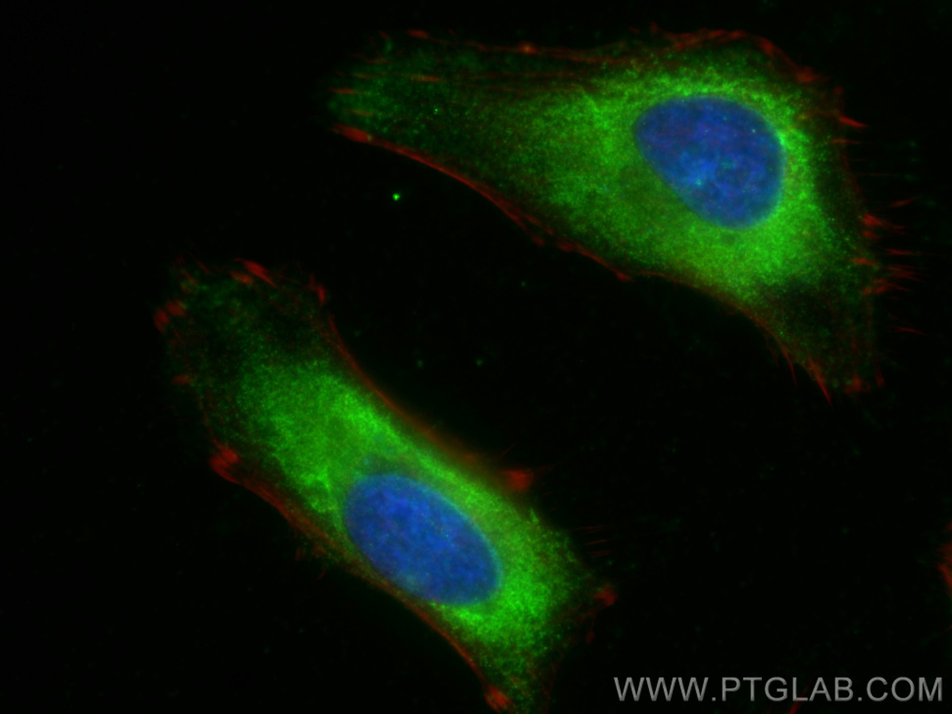 Immunofluorescence (IF) / fluorescent staining of HeLa cells using CSDE1 Polyclonal antibody (13319-1-AP)