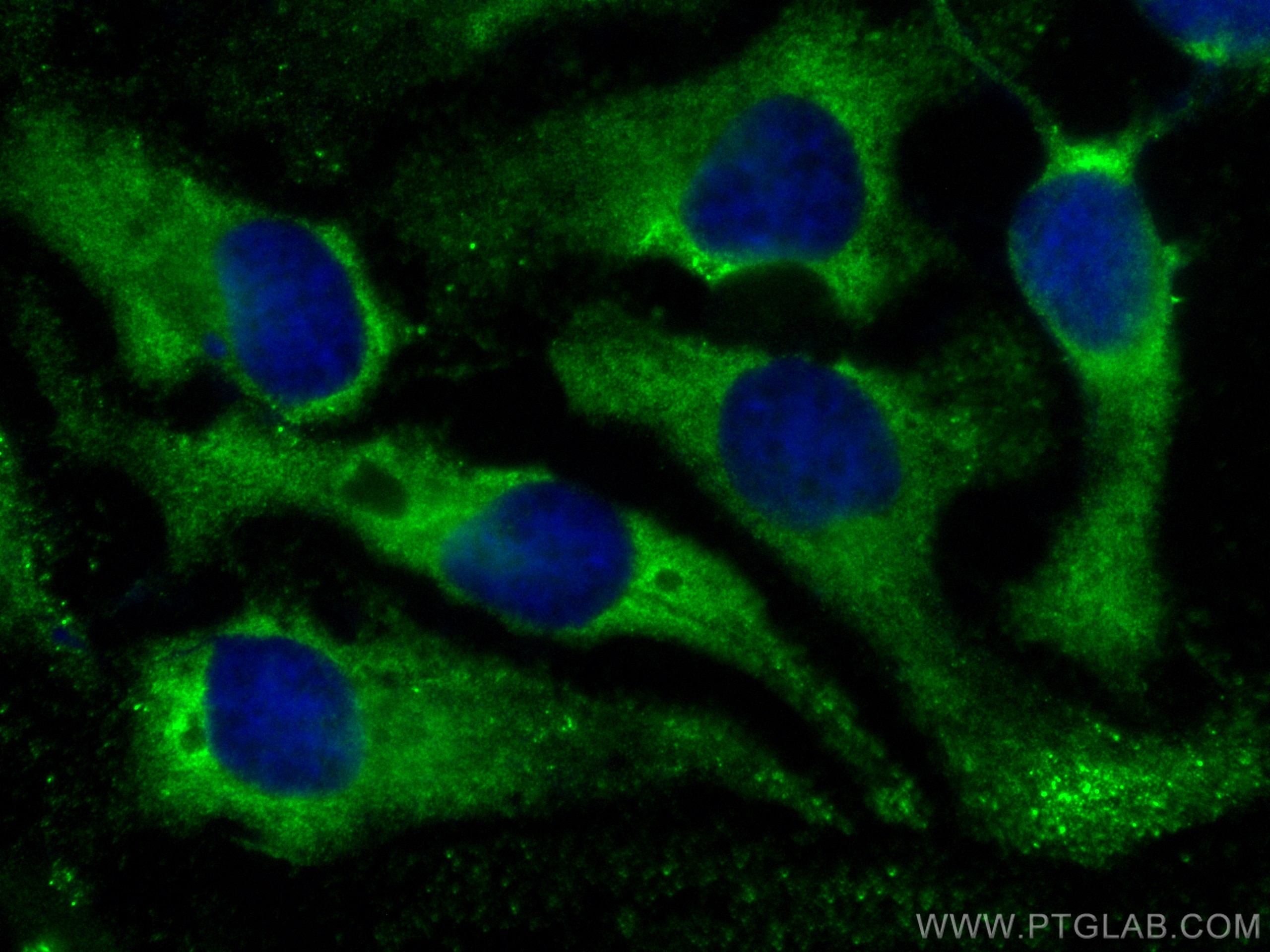 Immunofluorescence (IF) / fluorescent staining of HeLa cells using CoraLite® Plus 488-conjugated CSDE1 Polyclonal ant (CL488-13319)