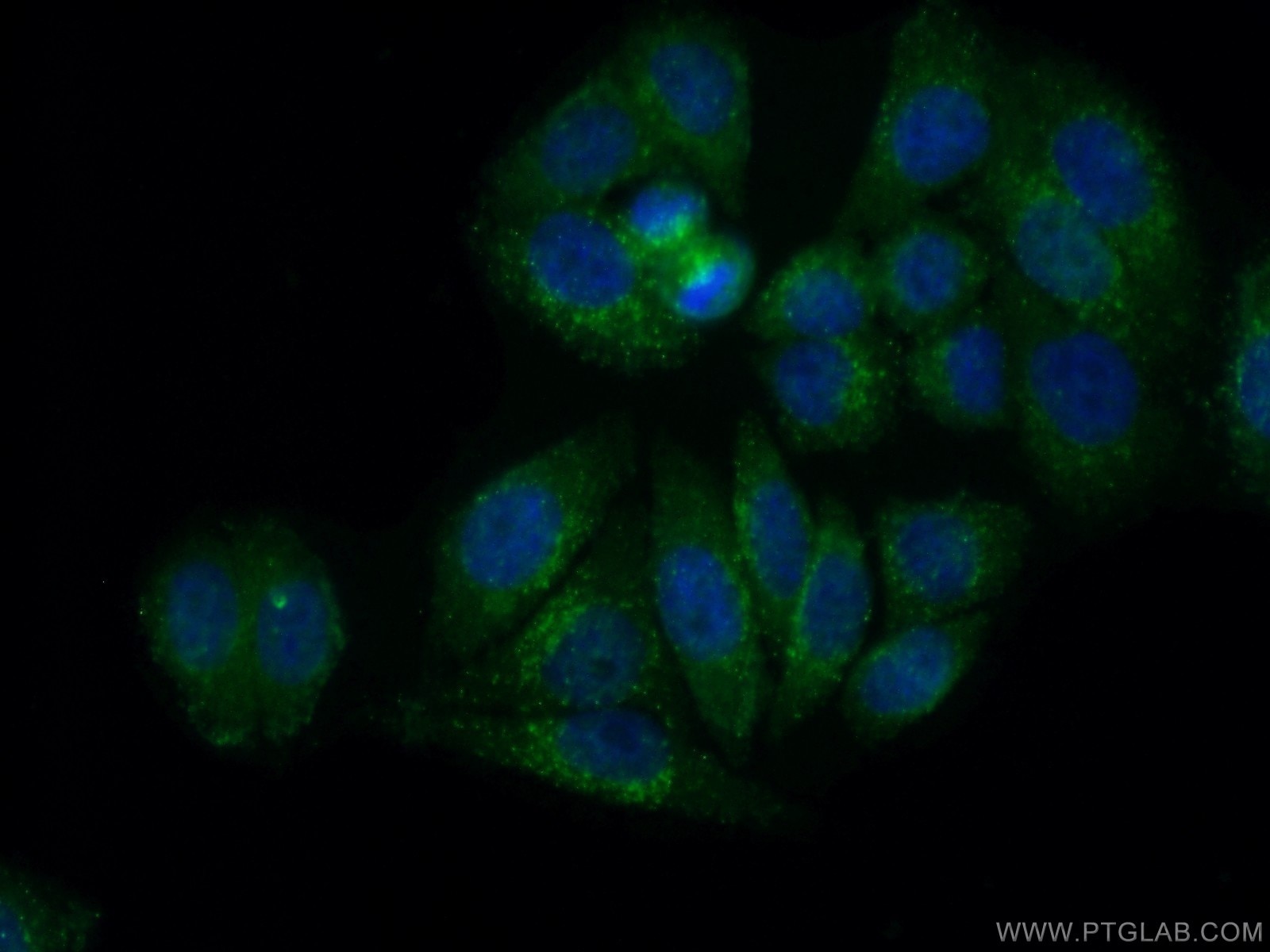 Immunofluorescence (IF) / fluorescent staining of HepG2 cells using Gamma Cystathionase Monoclonal antibody (60234-1-Ig)