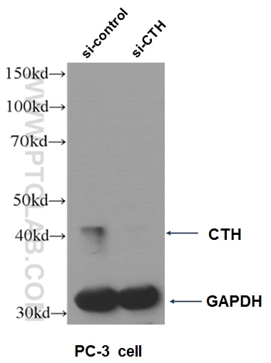 Western Blot (WB) analysis of PC-3 cells using Gamma Cystathionase Monoclonal antibody (60234-1-Ig)