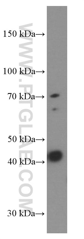 Western Blot (WB) analysis of HeLa cells using Gamma Cystathionase Monoclonal antibody (60234-1-Ig)