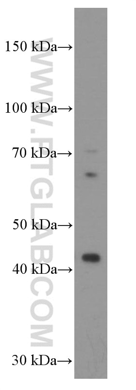 Western Blot (WB) analysis of A431 cells using Gamma Cystathionase Monoclonal antibody (60234-1-Ig)