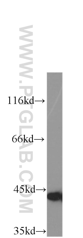 Gamma Cystathionase