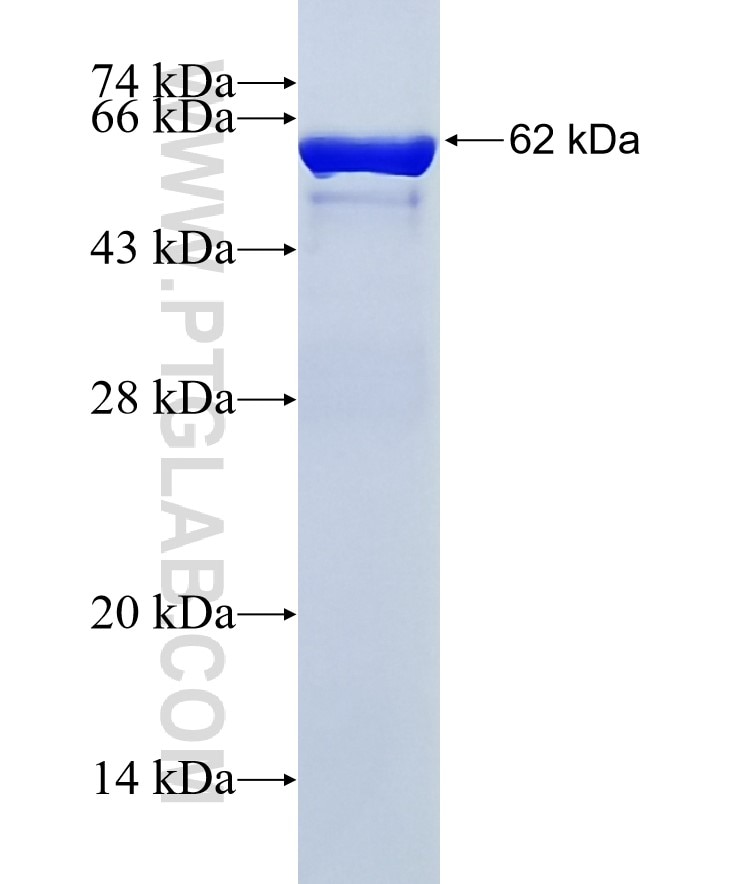 CSE fusion protein Ag2872 SDS-PAGE