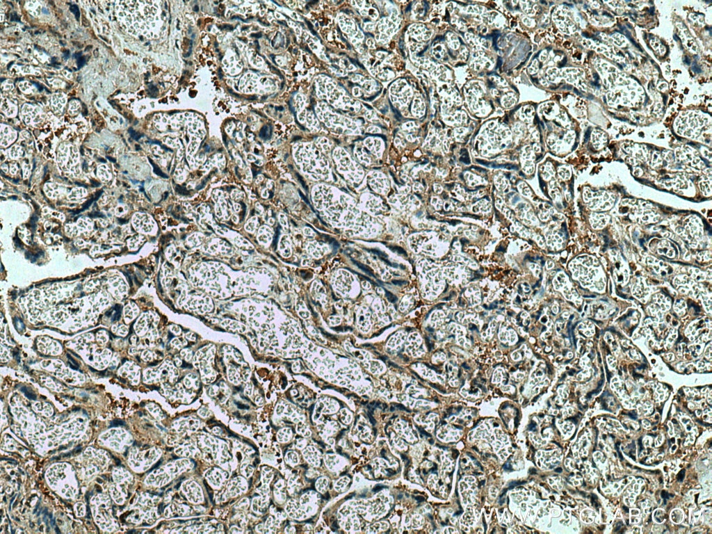 Immunohistochemistry (IHC) staining of human placenta tissue using CSE1L Polyclonal antibody (22219-1-AP)